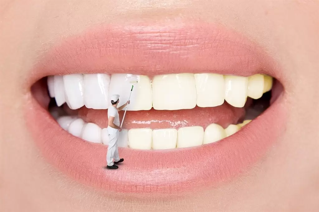 Dental whitening is a procedure that is bleaching of the yellowed teeth