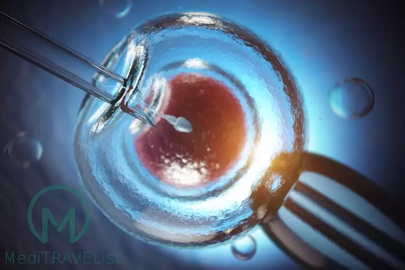 IVF microinjection ICSI is a method used in treatment of infertility