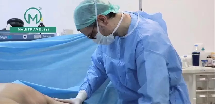 Liposuction Surgery video cover image