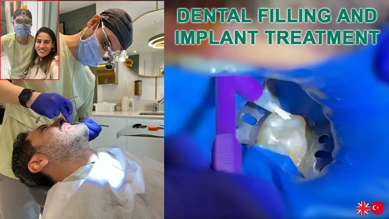 dental treatment process implant and filling meditravelist