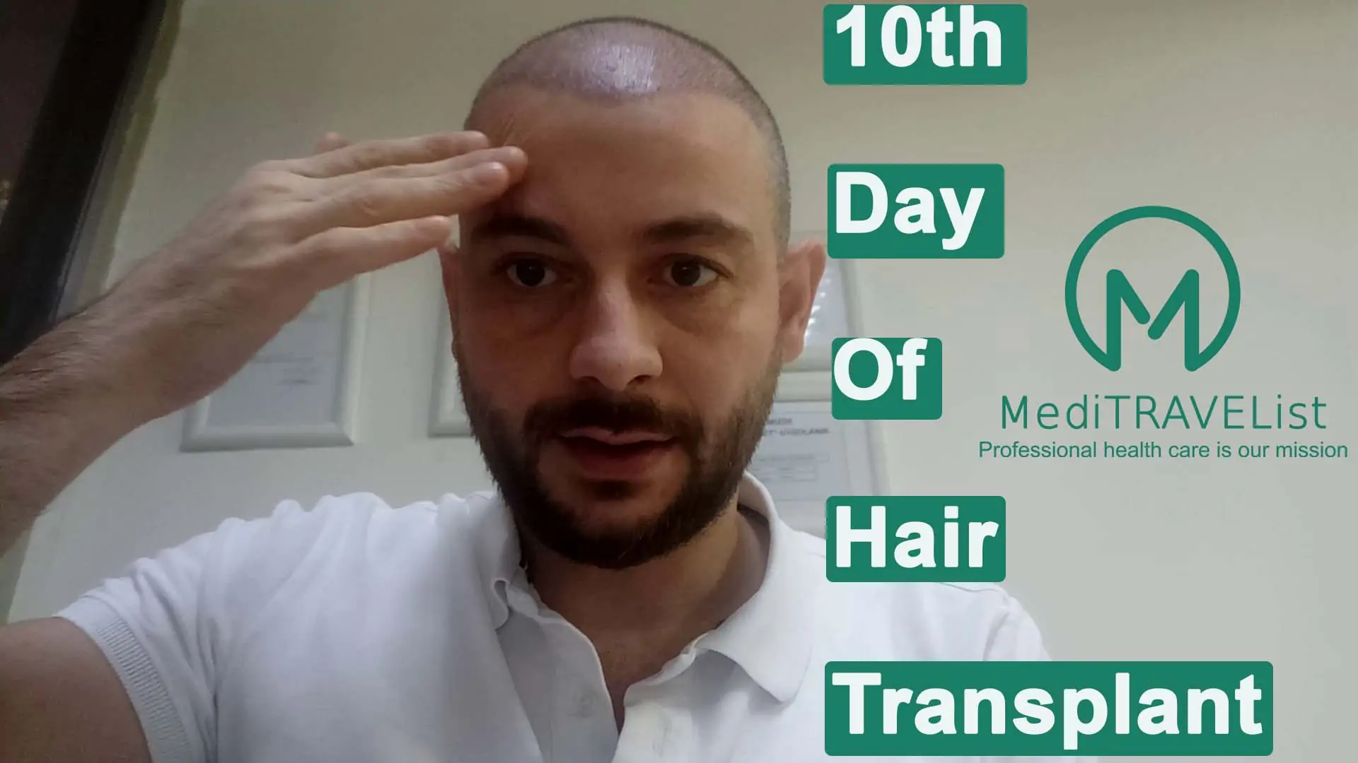 meditravelist samet review 10th day of hairtransplantation